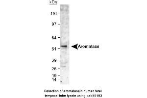 Image no. 1 for anti-Cytochrome P450, Family 19, Subfamily A, Polypeptide 1 (CYP19A1) (C-Term) antibody (ABIN363492) (Aromatase anticorps  (C-Term))