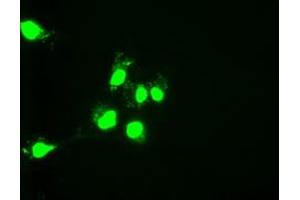 anti-One Cut Homeobox 1 (ONECUT1) (AA 85-198) antibody