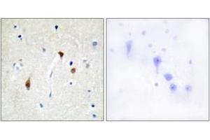 Immunohistochemistry analysis of paraffin-embedded human brain tissue, using HAIR Antibody. (Hairless anticorps  (AA 41-90))
