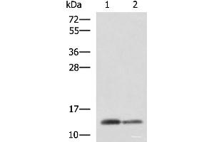 Western blot analysis of Human breast tissue and Human thyroid tissue lysates using CRABP1 Polyclonal Antibody at dilution of 1:2000