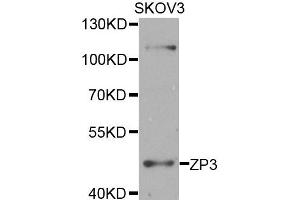 Western blot analysis of extracts of SKOV3 cells, using ZP3 antibody. (Zona Pellucida Glycoprotein 3 anticorps)