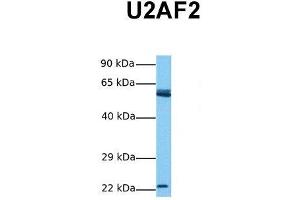 Host:  Rabbit  Target Name:  U2AF2  Sample Tissue:  Human Jurkat  Antibody Dilution:  1. (U2AF2 anticorps  (N-Term))