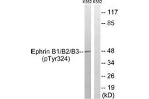 Western blot analysis of extracts from K562 cells treated with serum 20% 15', using Ephrin B1/B2/B3 (Phospho-Tyr324) Antibody. (Ephrin B1/B2/B3 (AA 290-339), (pTyr324) anticorps)