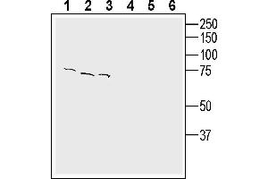 Western blot analysis of human  breast adenocarcinoma cell line lysate (lanes 1 and 4), human Colo 205 colon adenocarcinoma (lanes 2 and 5) and human K562 chronic myelogenous leukemia cell line lysate (lanes 3 and 6):1-3.