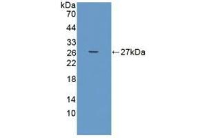Detection of Recombinant ADAMTS9, Human using Polyclonal Antibody to A Disintegrin And Metalloproteinase With Thrombospondin 9 (ADAMTS9) (ADAMTS9 anticorps  (AA 1727-1935))