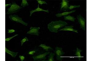Immunofluorescence of monoclonal antibody to GFRA1 on HeLa cell.
