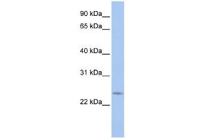 WB Suggested Anti-PRELID2 Antibody Titration: 0. (PRELID2 anticorps  (C-Term))