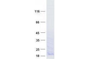 Validation with Western Blot