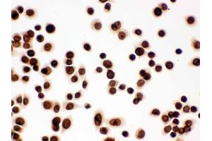 IHC analysis of Lamin B1 using anti-Lamin B1 antibody .