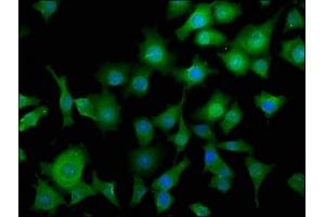Immunofluorescence staining of SH-SY5Y cells with ABIN7164419 at 1:50, counter-stained with DAPI.