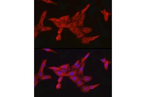 Immunofluorescence analysis of PC-12 cells using IKKβ Rabbit mAb (ABIN7267873) at dilution of 1:100 (40x lens).