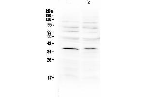 Western blot analysis of MATH1/HATH1 using anti-MATH1/HATH1 antibody . (ATOH1 anticorps  (N-Term))