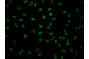 Immunofluorescence staining of Hela Cells with ABIN7127523 at 1:50, counter-stained with DAPI.