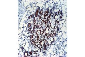 Paraformaldehyde-fixed, paraffin embedded human colon carcinoma tissue, Antigen retrieval by boiling in sodium citrate buffer (pH6.