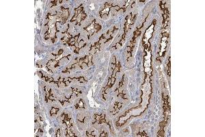Immunohistochemical staining of human kidney with MDGA1 polyclonal antibody  shows strong membranous positivity in cells in tubules. (MDGA1 anticorps)