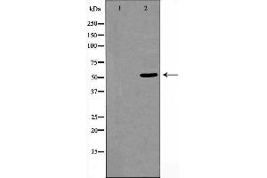 Western blot analysis of extracts from HeLa cells using CELF-1 antibody. (CELF1 anticorps  (N-Term))