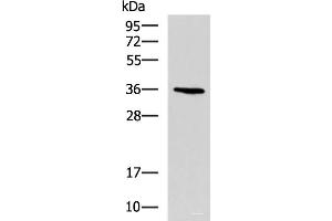 Western blot analysis of A549 cell lysate using BDNF Polyclonal Antibody at dilution of 1:900 (BDNF anticorps)