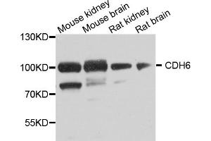 Western blot analysis of extracts of various cell lines, using CDH6 antibody (ABIN5974784) at 1/1000 dilution. (CDH6 anticorps)