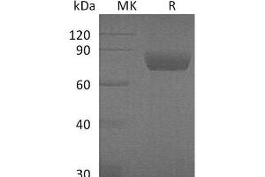 Western Blotting (WB) image for serpin Peptidase Inhibitor, Clade D (Heparin Cofactor), Member 1 (SERPIND1) protein (His tag) (ABIN7320642)