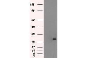 Western Blotting (WB) image for anti-Cardiac Troponin I (TNNI3) (AA 1-210) antibody (ABIN1490609) (TNNI3 anticorps  (AA 1-210))