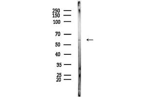 Western blot analysis of lysates from PC12 cells, using PRPF4 Antibody at 1/1000 dilution.