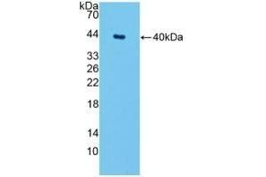 Detection of Recombinant SPTLC1, Mouse using Polyclonal Antibody to Serine Palmitoyltransferase, Long Chain Base Subunit 1 (SPTLC1)