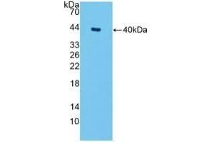 Detection of Recombinant SPTLC1, Mouse using Polyclonal Antibody to Serine Palmitoyltransferase, Long Chain Base Subunit 1 (SPTLC1) (SPTLC1 anticorps  (AA 143-473))
