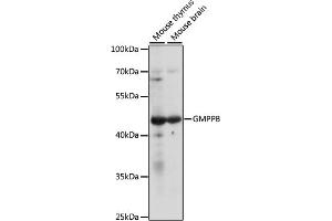 Western blot analysis of extracts of various cell lines, using GMPPB antibody (ABIN7267363) at 1:1000 dilution.