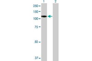 Western Blot analysis of CSF3R expression in transfected 293T cell line by CSF3R MaxPab polyclonal antibody. (CSF3R anticorps  (AA 1-836))