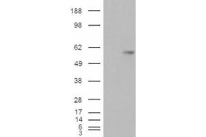Western Blotting (WB) image for anti-V-Set Domain Containing T Cell Activation Inhibitor 1 (VTCN1) (Internal Region) antibody (ABIN2466446) (VTCN1 anticorps  (Internal Region))