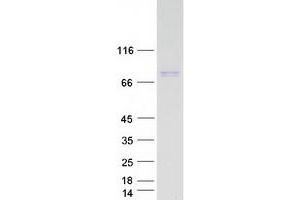 Validation with Western Blot