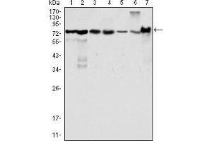 Western blot analysis using LPP mouse mAb against Hela (1), NIH/3T3 (2), COS (3), Caki (4), MCF-7 (5), HepG2 (6) and SMMC-7721 (7) cell lysate. (LPP anticorps)