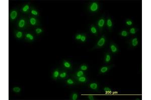 Immunofluorescence of monoclonal antibody to HDAC1 on HeLa cell. (HDAC1 anticorps  (AA 1-482))