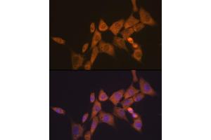Immunofluorescence analysis of NIH-3T3 cells using  Rabbit mAb (ABIN7265787) at dilution of 1:100 (40x lens).