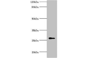 Western blot All lanes: N-alpha-acetyltransferase 10 antibody at 5 μg/mL + Hela whole cell lysate Secondary Goat polyclonal to rabbit IgG at 1/10000 dilution Predicted band size: 27, 25 kDa Observed band size: 27 kDa (PTPDC1 anticorps  (AA 161-235))