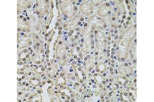 Immunohistochemistry of paraffin-embedded Rat kidney using SMARCC2 Polyclonal Antibody at dilution of 1:100 (40x lens). (SMARCC2 anticorps)