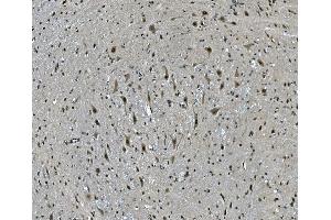 IHC analysis of LSM7 using anti-LSM7 antibody (ABIN7598937). (LSM7 anticorps  (AA 1-103))