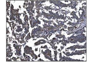 IHC analysis of CD39/ENTPD1 using anti-CD39/ENTPD1 antibody (ABIN7602461).