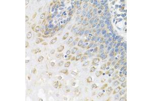 Immunohistochemistry of paraffin-embedded human esophagus using PABPC4 antibody.