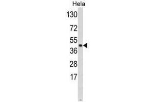 Western blot analysis of SKP2 Antibody (Center) in Hela cell line lysates (35ug/lane). (SKP2 anticorps  (Middle Region))
