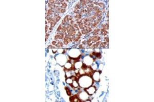 Image no. 2 for anti-Pancreatic and Duodenal Homeobox 1 (PDX1) (C-Term) antibody (ABIN374551) (PDX1 anticorps  (C-Term))