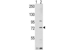 Western blot analysis of PAK1 antibody and 293 cell lysate either nontransfected (Lane 1) or transiently transfected with the PAK1 gene (2). (PAK1 anticorps  (AA 401-430))
