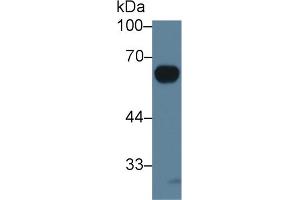Western Blot; Sample: Rat Serum; Primary Ab: 3µg/ml Rabbit Anti-Rat IL20Ra Antibody Second Ab: 0.