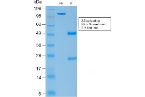 SDS-PAGE Analysis Purified ACTH Rabbit Recombinant Monoclonal Antibody (CLIP/2040R). (Recombinant POMC anticorps  (AA 1-24))