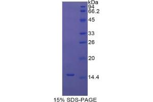 SDS-PAGE analysis of Rat UCP1 Protein. (UCP1 Protéine)