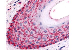 Anti-FAP antibody IHC of human skin, hair follicle.