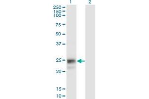 Western Blot analysis of NAAA expression in transfected 293T cell line by NAAA monoclonal antibody (M02), clone 3F4.