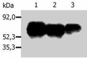 Immunoprecipitation of human PAG1 from the lysate of Raji human Burkitt lymphoma cell line. (PAG1 anticorps  (C-Term))
