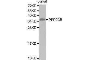 Western blot analysis of extracts of Jurkat cell lines, using PPP2CB antibody. (PPP2CB anticorps  (AA 1-309))