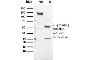 SDS-PAGE Analysis Purified CD3e Rabbit Recombinant Monoclonal Antibody (C3e/3125R).